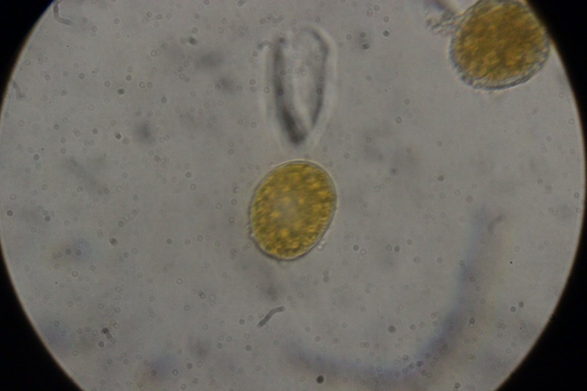 Halde Rungenberg-3746.jpg