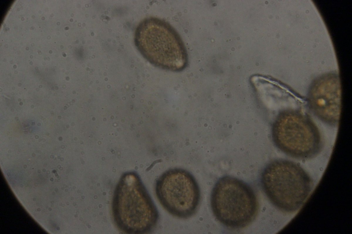 Halde Rungenberg-3753.jpg