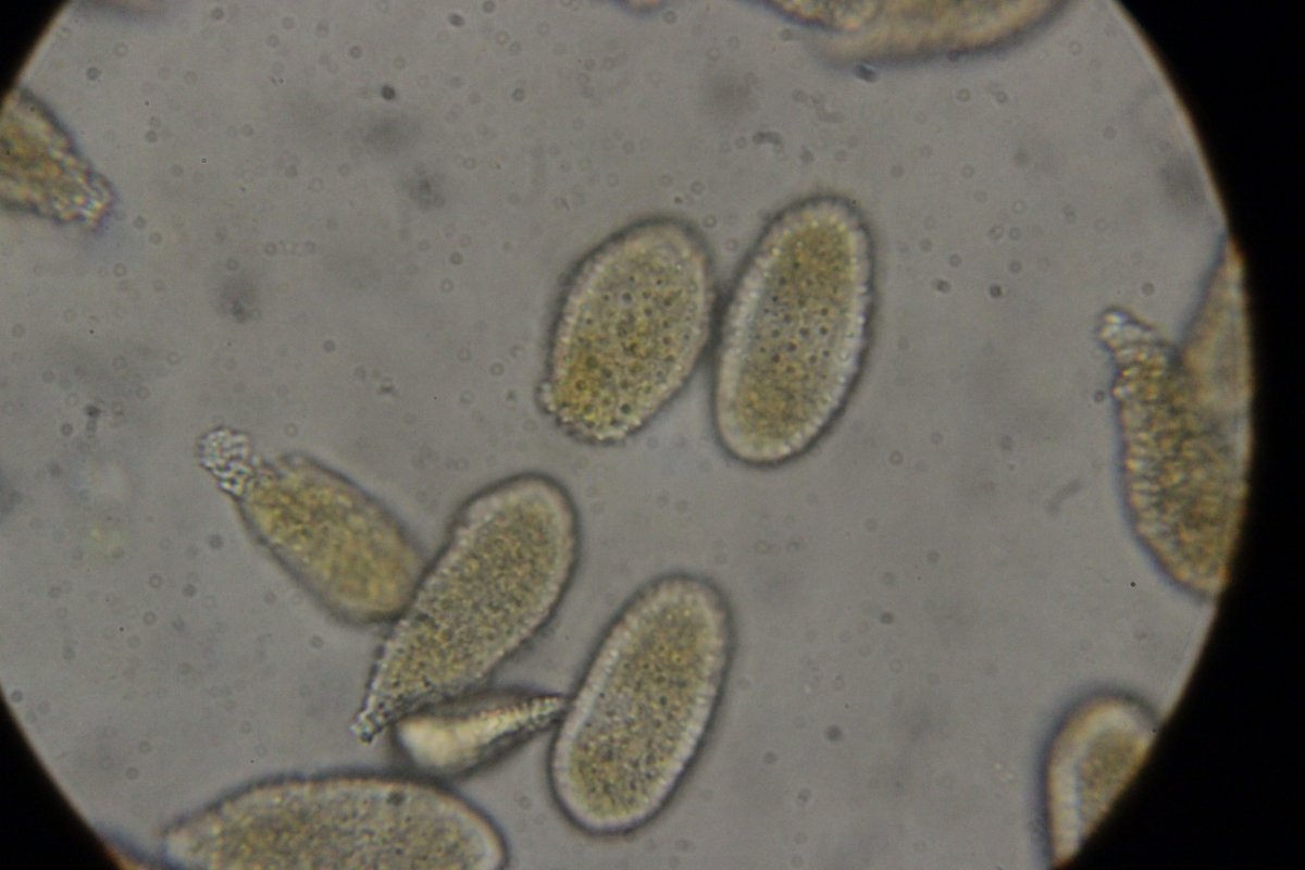 Halde Rungenberg-0365.jpg