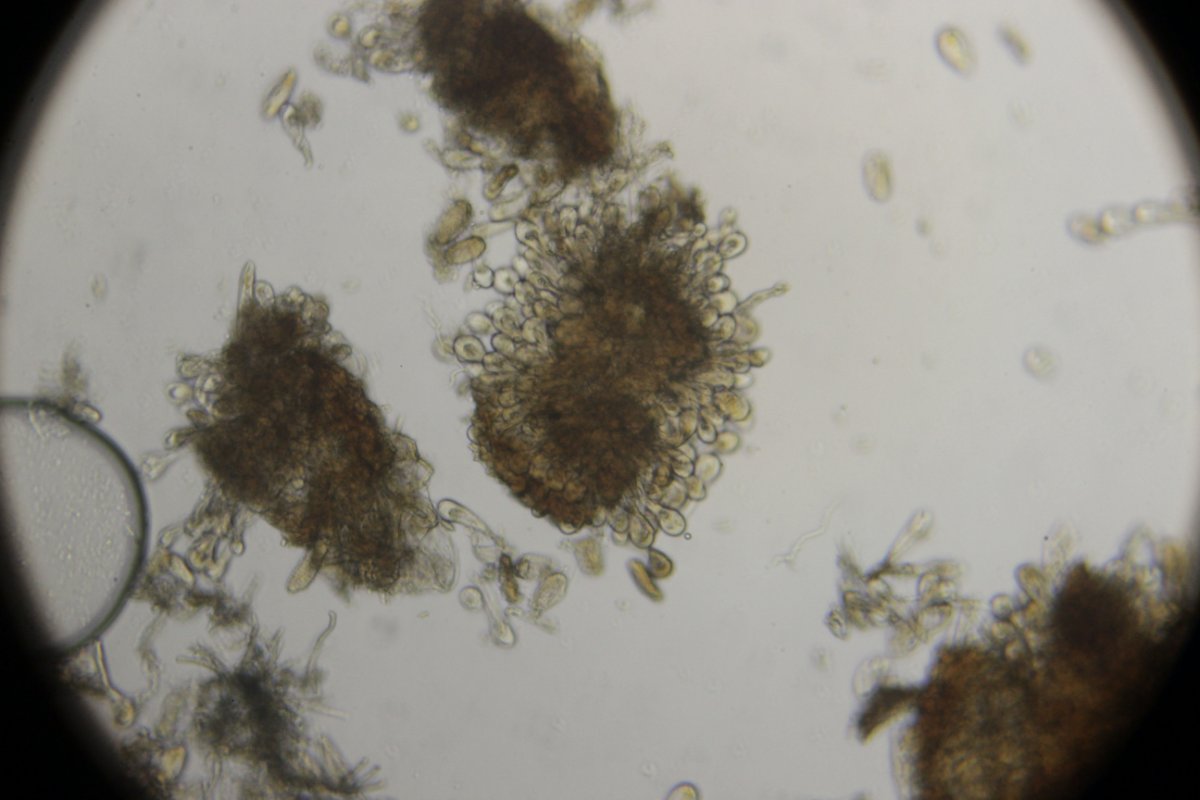 Halde Rungenberg-0373.jpg