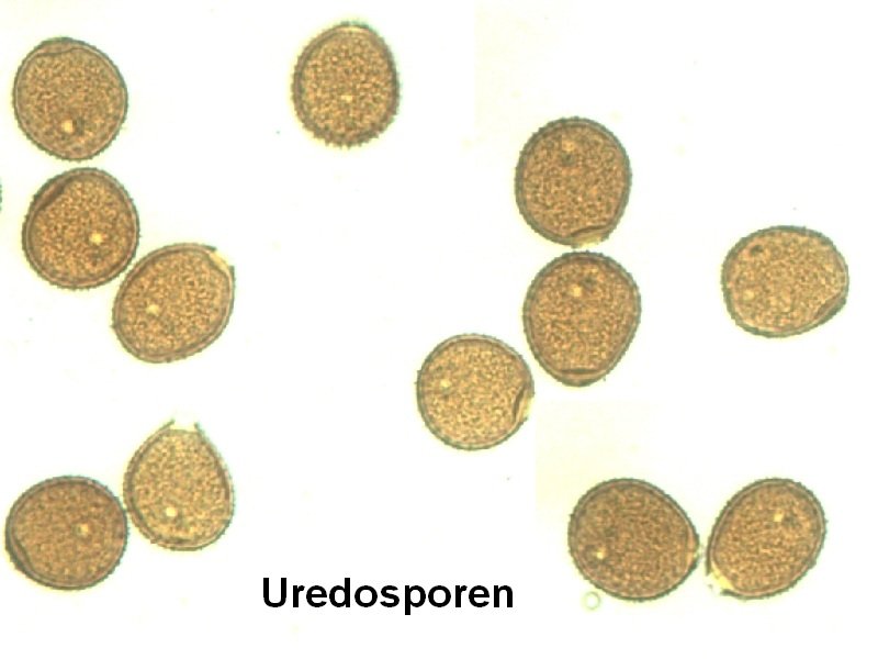 Centaurea macrocephala Uredosporen 1.jpg