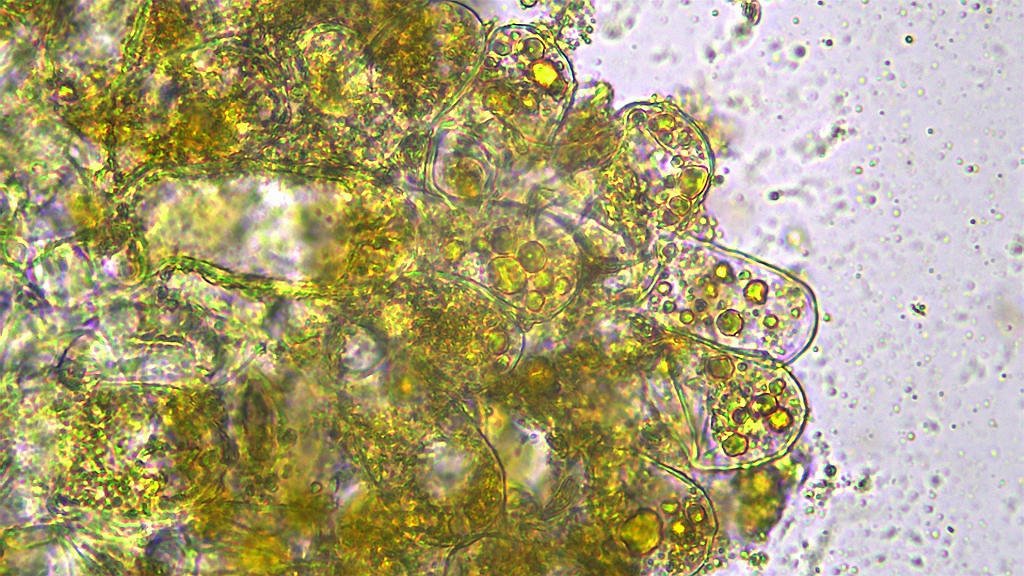 Taphrina johansonii006.jpg