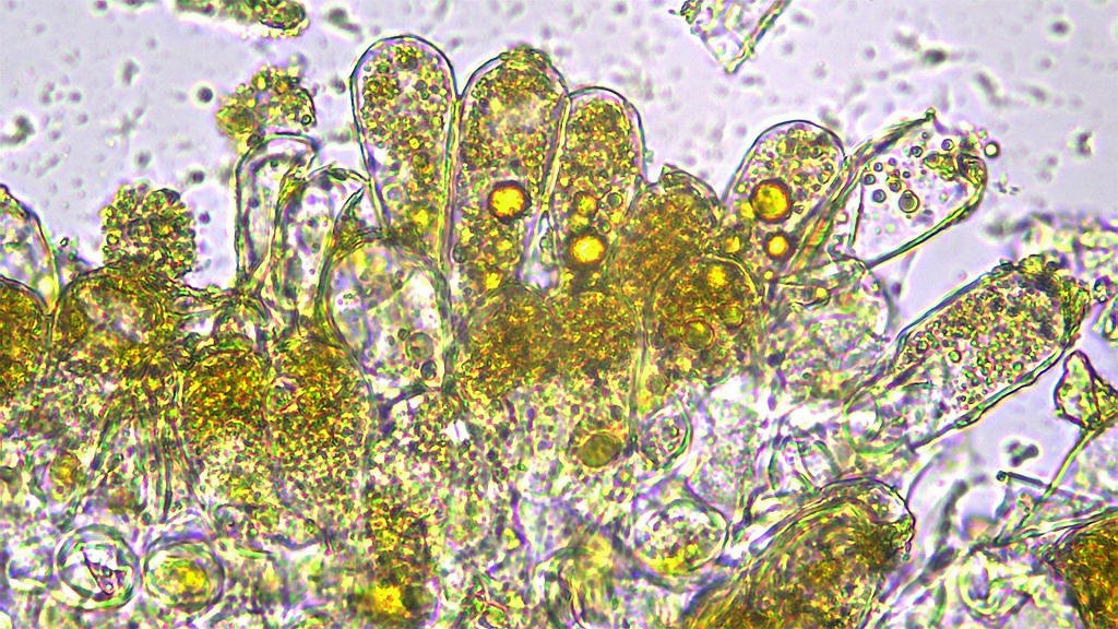 Taphrina johansonii007.jpg