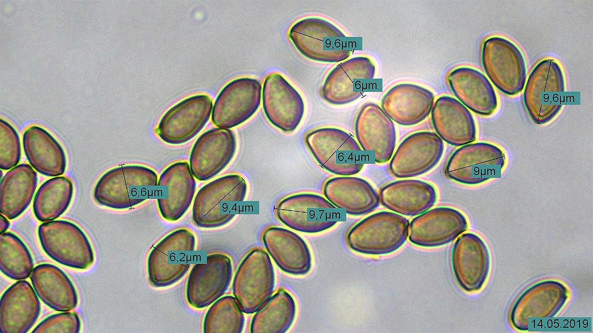 Sporenpräparat mit Messung - 100fach