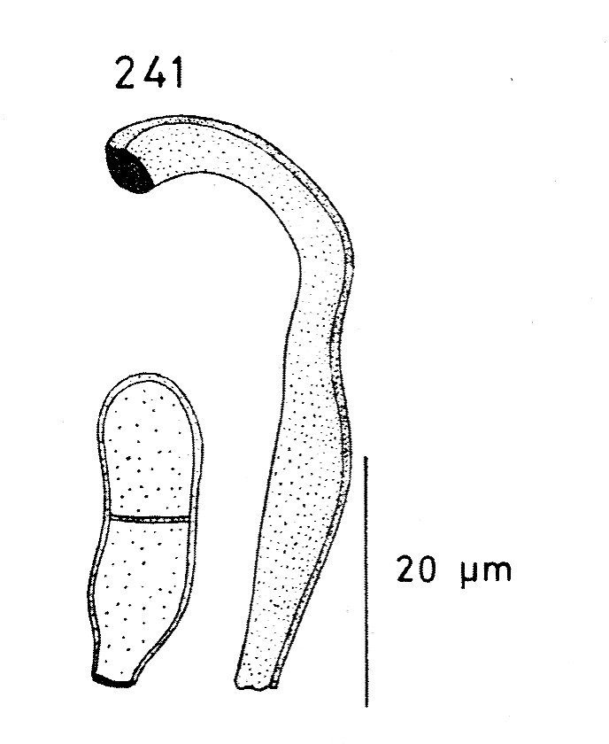 0-Fusicladiella melaena.jpg