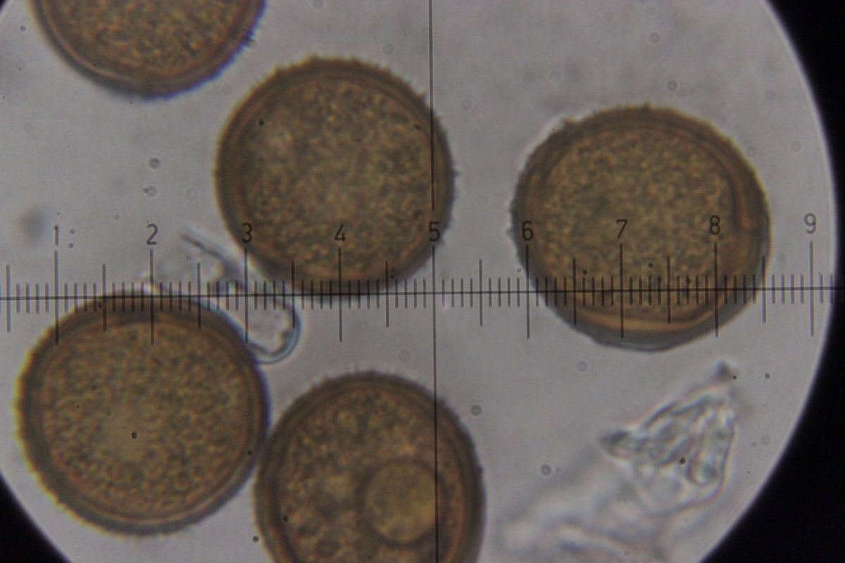 Herten und Hoheward-0122.jpg