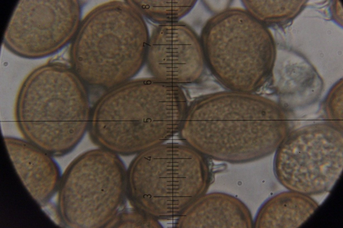 Herten und Hoheward-0120.jpg