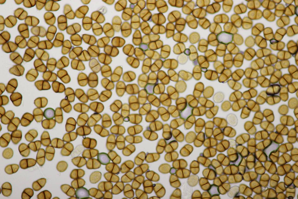 Stadtwald Duisburg-0020.jpg