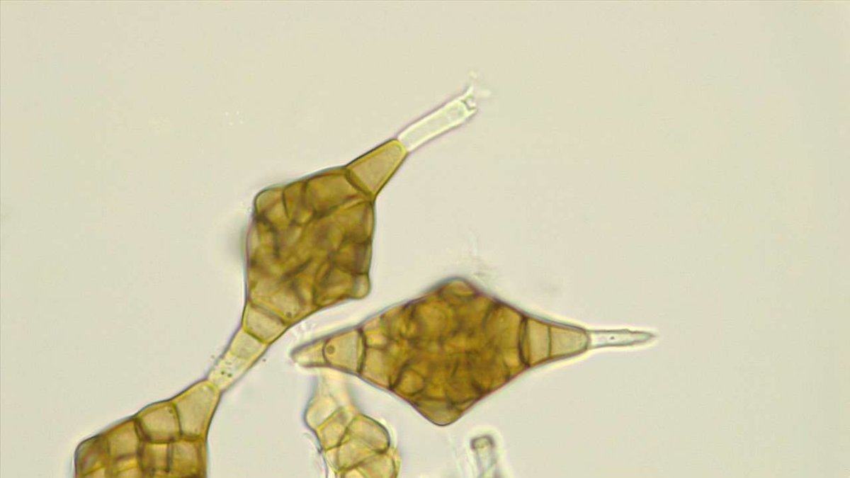 Phragmotrichium_chailletii_mik_gdi2.jpg