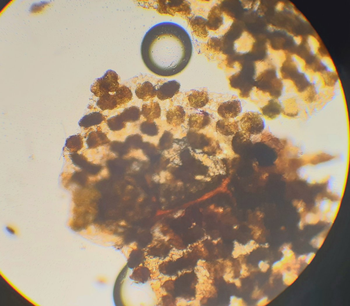 runde Gebilde, ca 100 µm