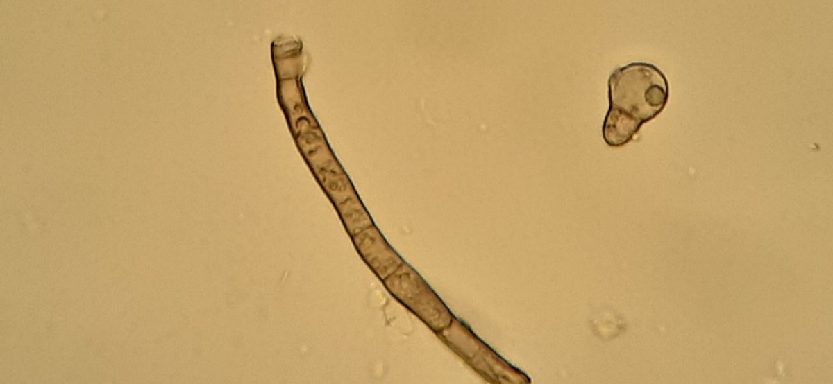 dunkle gegliederte Hyphen