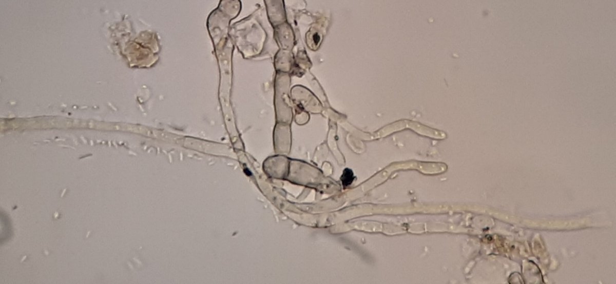 helle, ungegliederte Hyphen