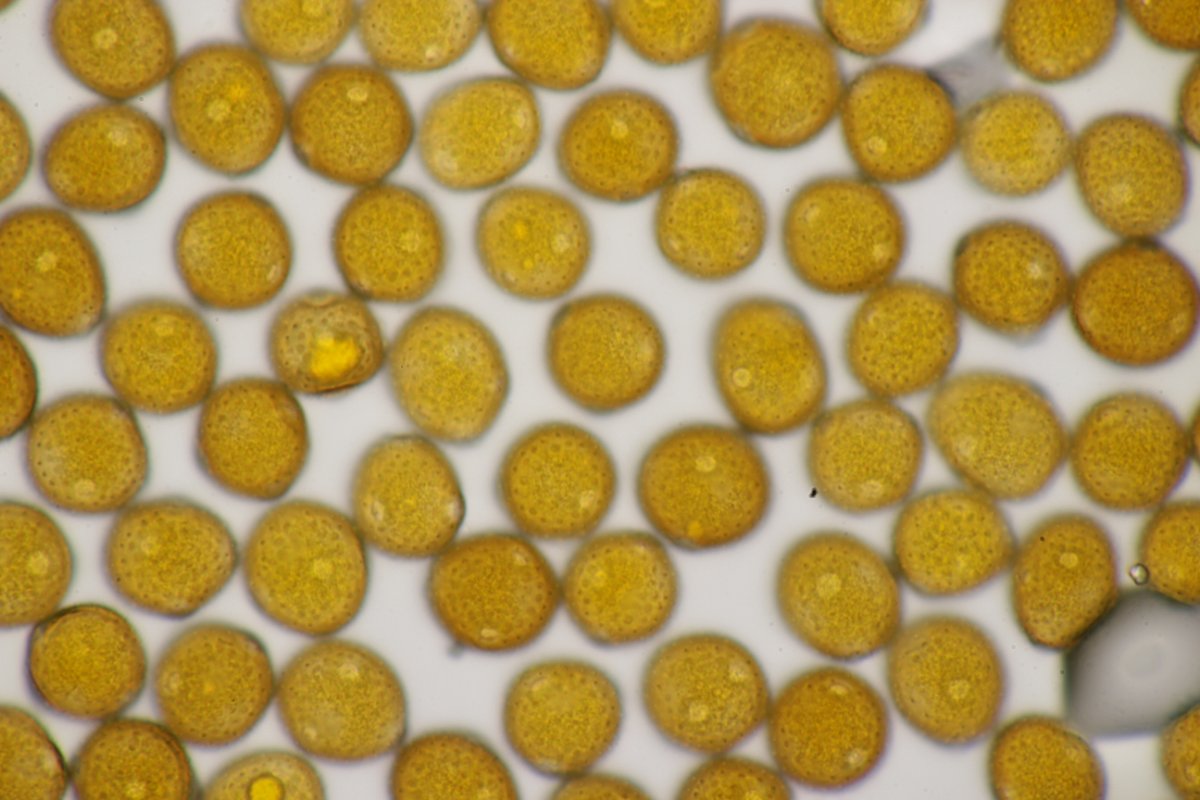 Stadtwald Duisburg-0059.jpg