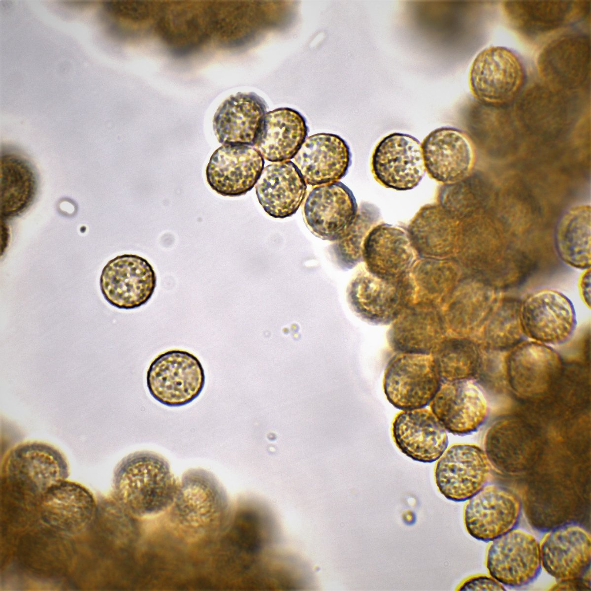 6 Bearbeitung Enteridium lycoperdon Sporen 100x Öl 3.jpg