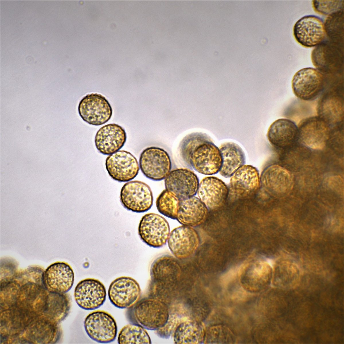 7 Bearbeitung Enteridium lycoperdon Sporen 100x Öl 4b.jpg