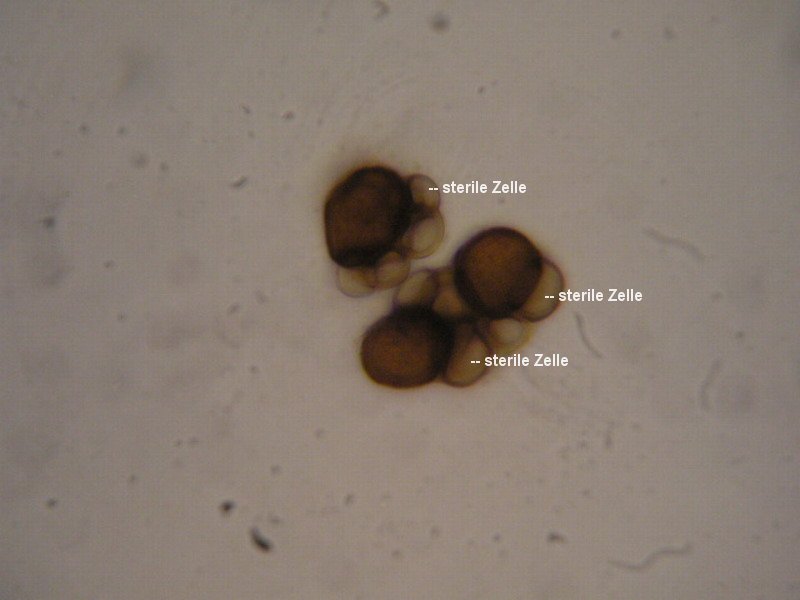 4-Urocystis ranunculi-1.6.1.3.3.69M5-Ranunculus montanus-JK.JPG