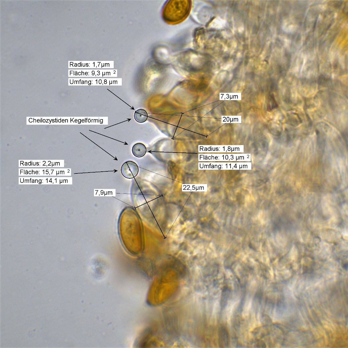 Messung Cheilozystiden 100x Öl Wasser 7.jpg