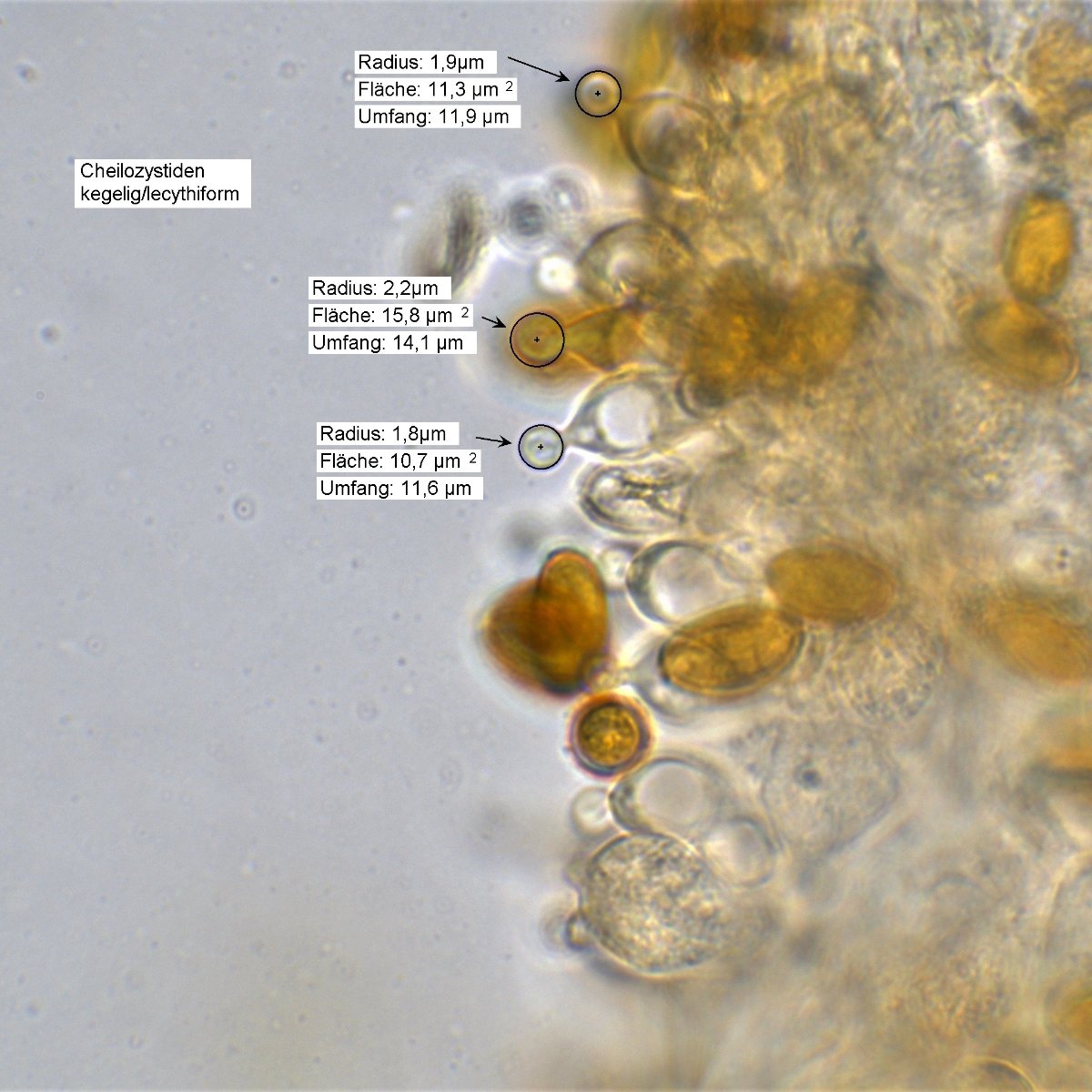Messung Cheilozystiden 100x Öl Wasser 8.jpg