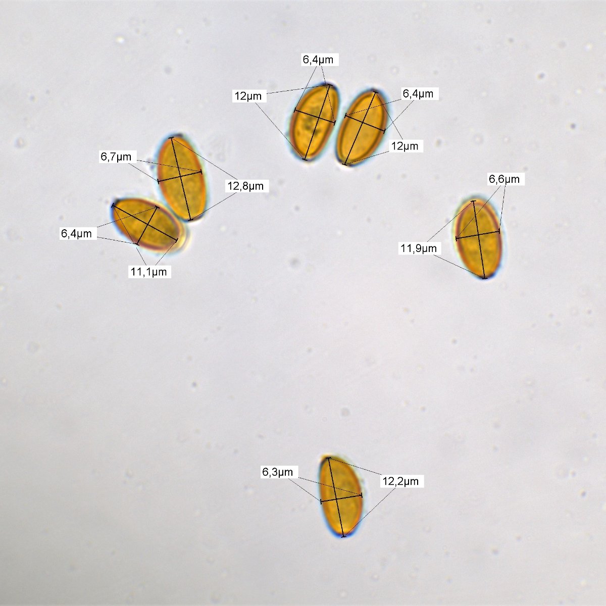 Messung Sporen 100x Öl Wasser 4.jpg