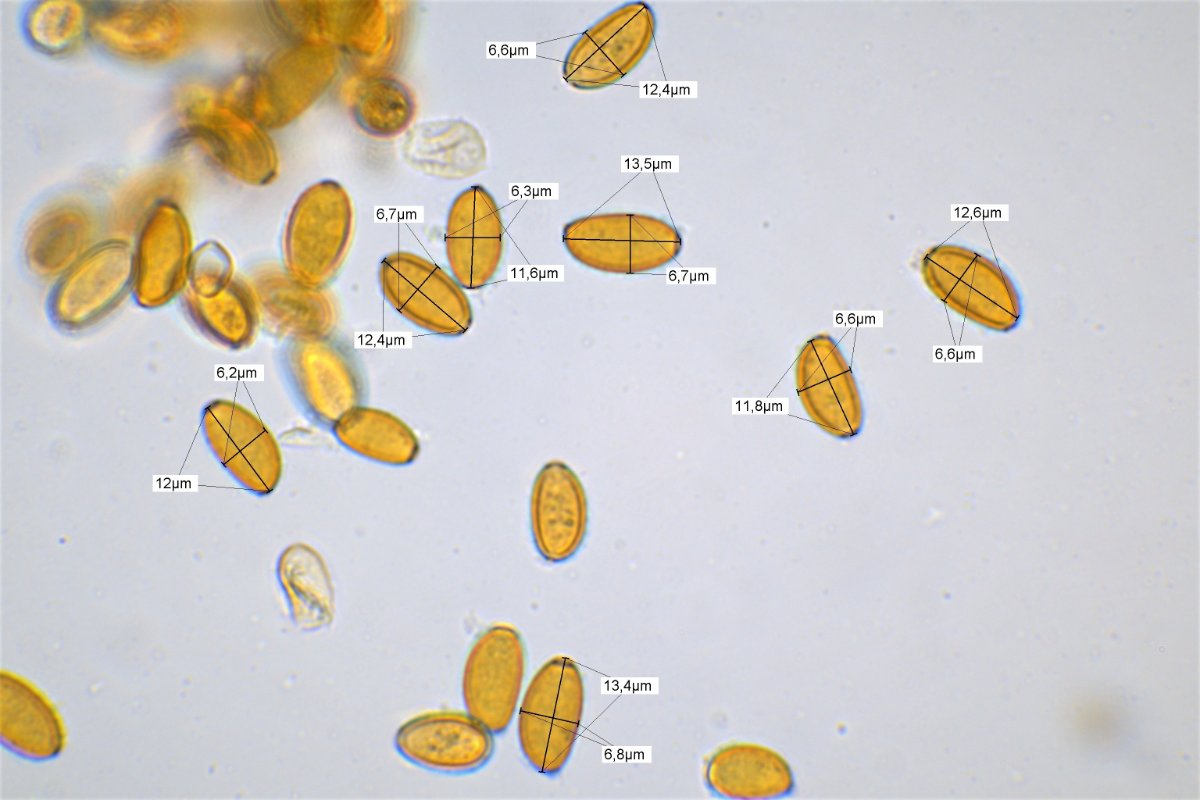 Messung Sporen 100x Öl Wasser 7.jpg