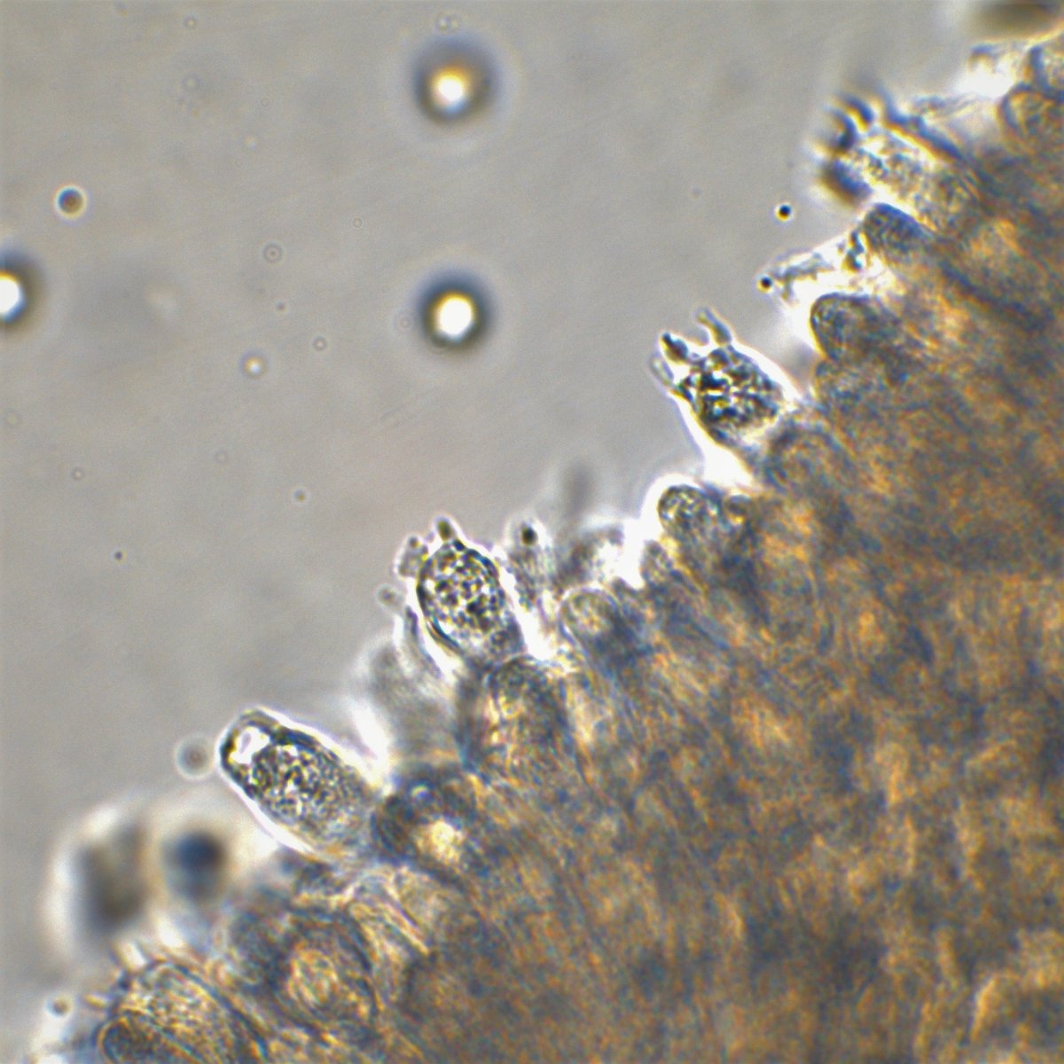 Siderophile Granutation 100x Öl Chloralhydrat 10.jpg