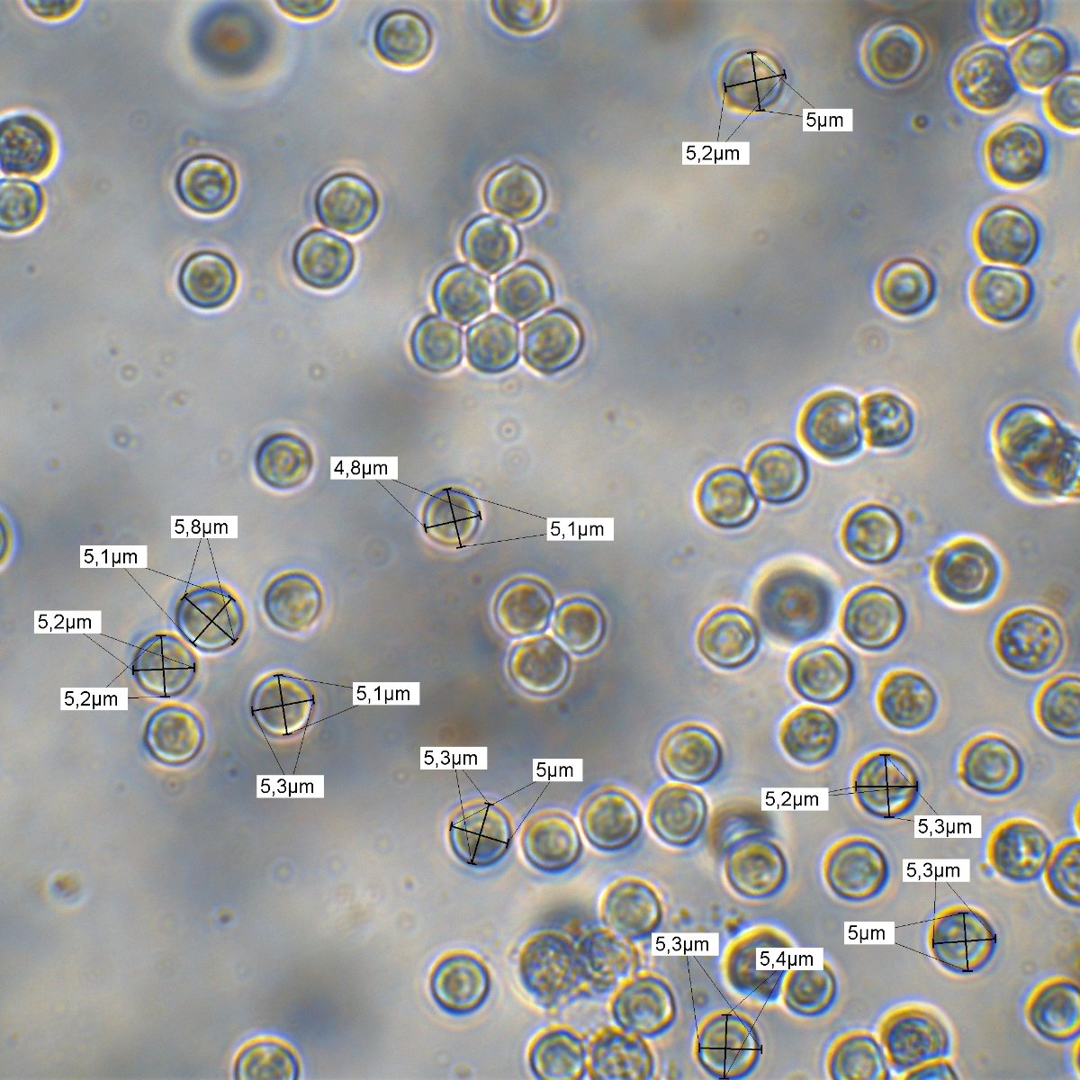 Messung Sporenabwurf 100x Öl Wasser 6.jpg