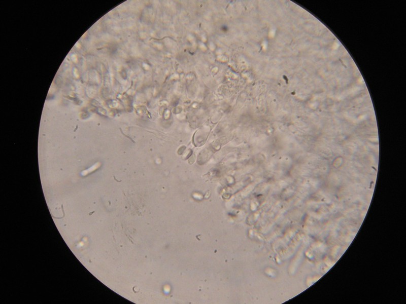 1000er Hildesheim.JPG