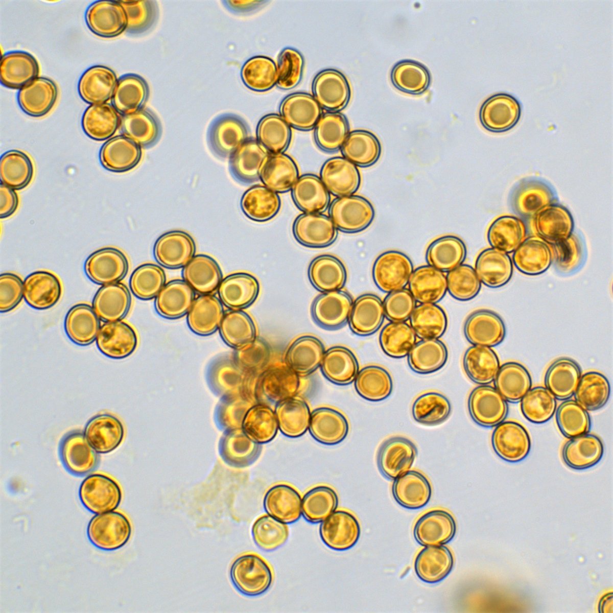 Sporenabwurf 100x Öl Melzer 11a.jpg