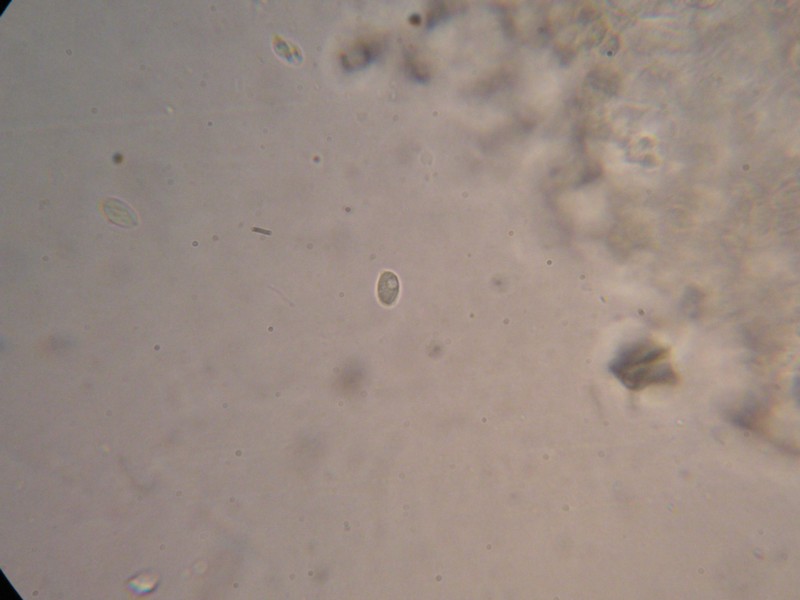 1000er Hildesheim (3).JPG