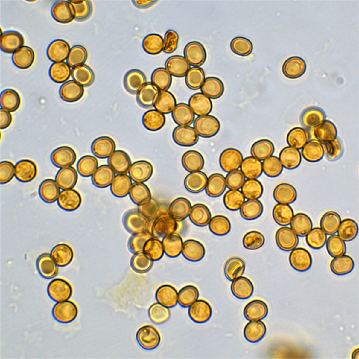 Sporenabwurf 100x Öl Melzer 12a.jpg