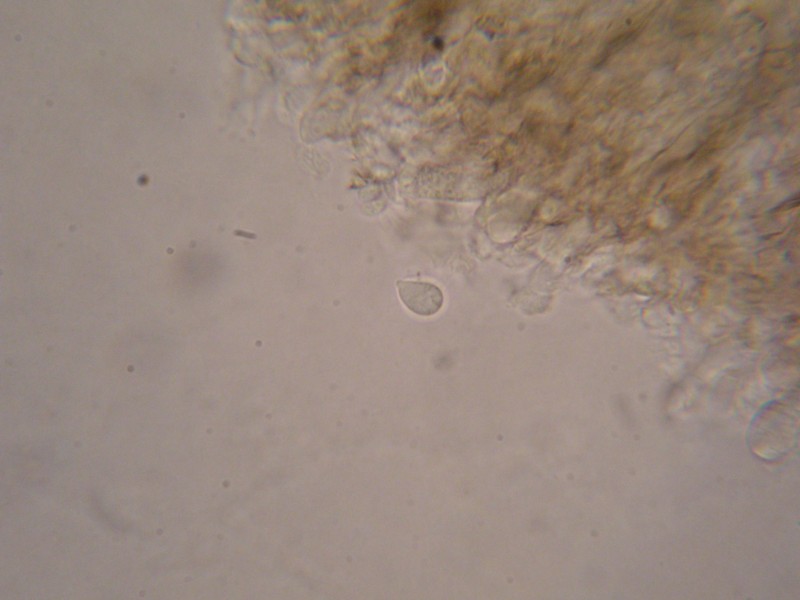 1000er Hildes (8).JPG