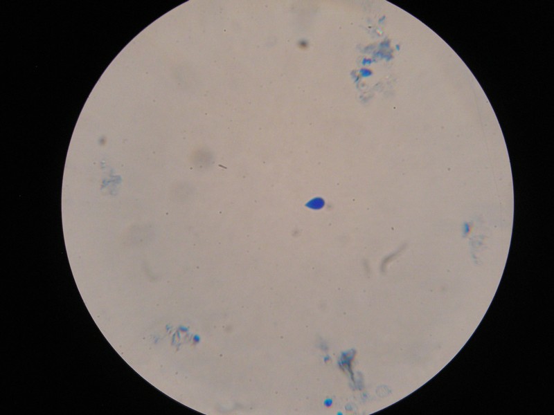 1000er Hildes (29).JPG