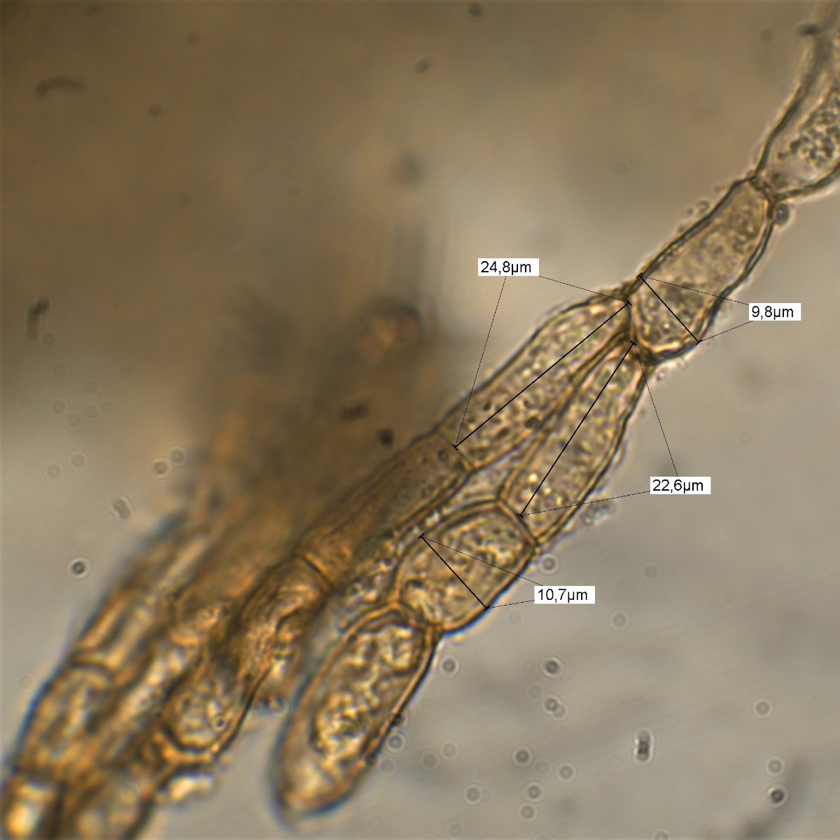 Messung Excipulum 100x Öl Wasser 6.jpg