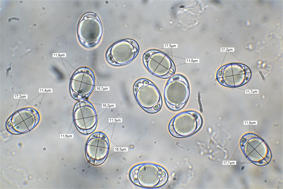 Messung Sporenabwurf 100x Öl Wasser 18.jpg