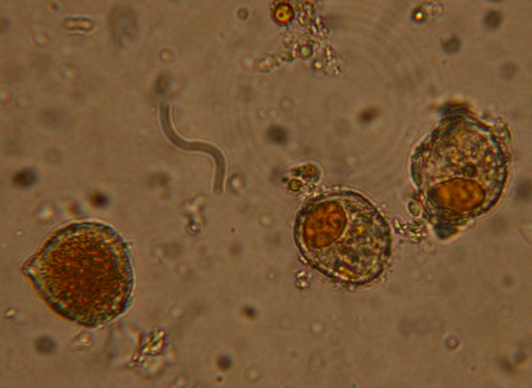 Sporen sind meist subglobos, ca 25ym DM, einzelne auch elliptisch bis 40x20