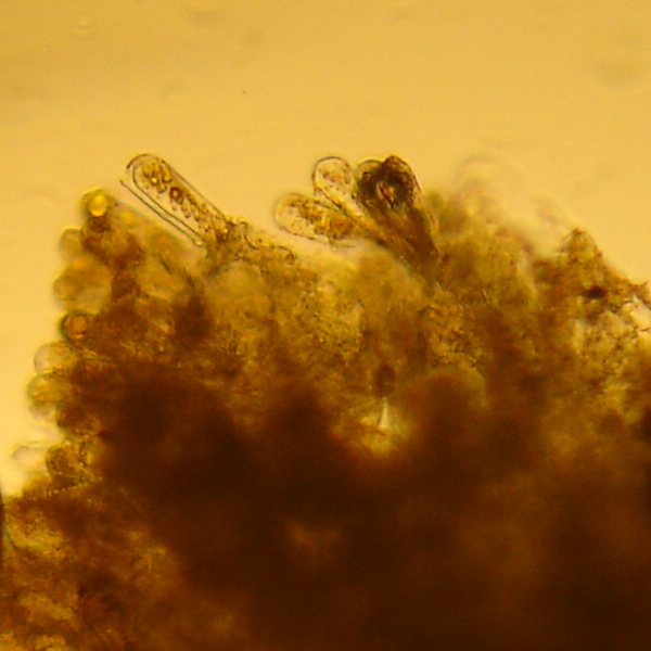 mikrobilderTaphrina rhizophora3.jpg