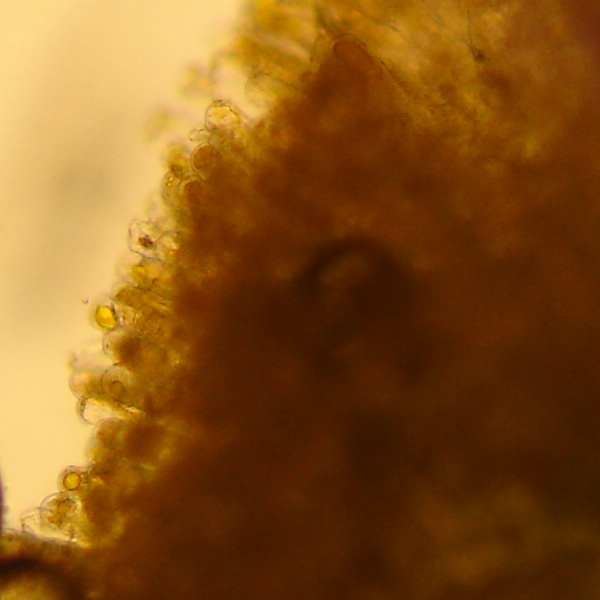 mikrobilderTaphrina rhizophora8.jpg