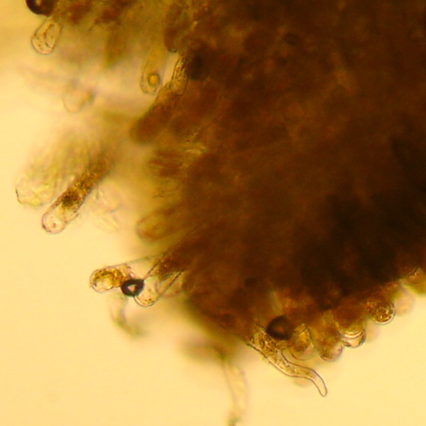 mikrobilderTaphrina rhizophora9.jpg