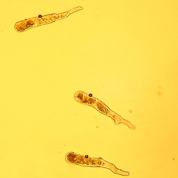 mikrobilderTaphrina rhizophora10.jpg