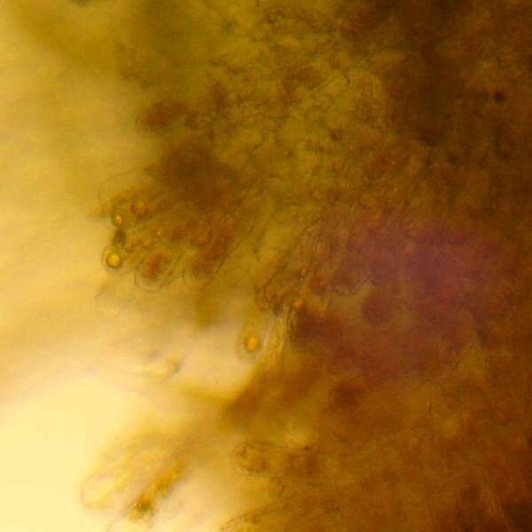 mikrobilderTaphrina rhizophora7.jpg