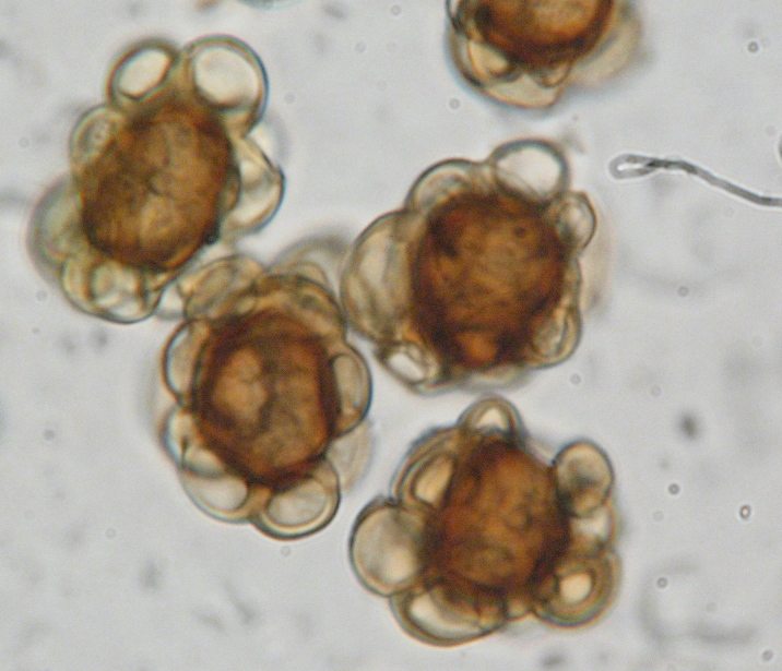 Urocystis_colchici_Sporen2.JPG