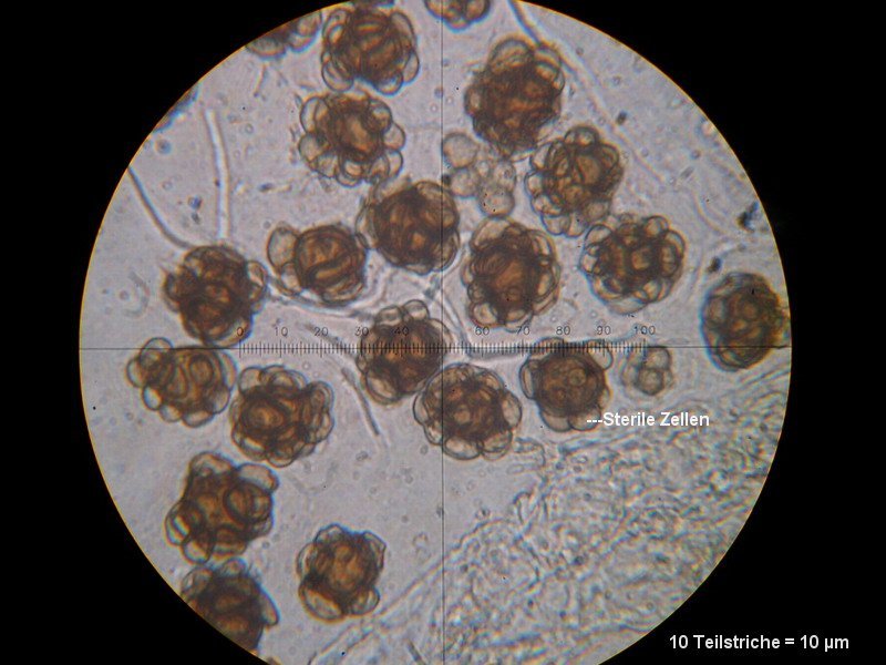 4-Urocystis eranthidis-1.6.3.3.28M2-Eranthis hyemalis.JPG