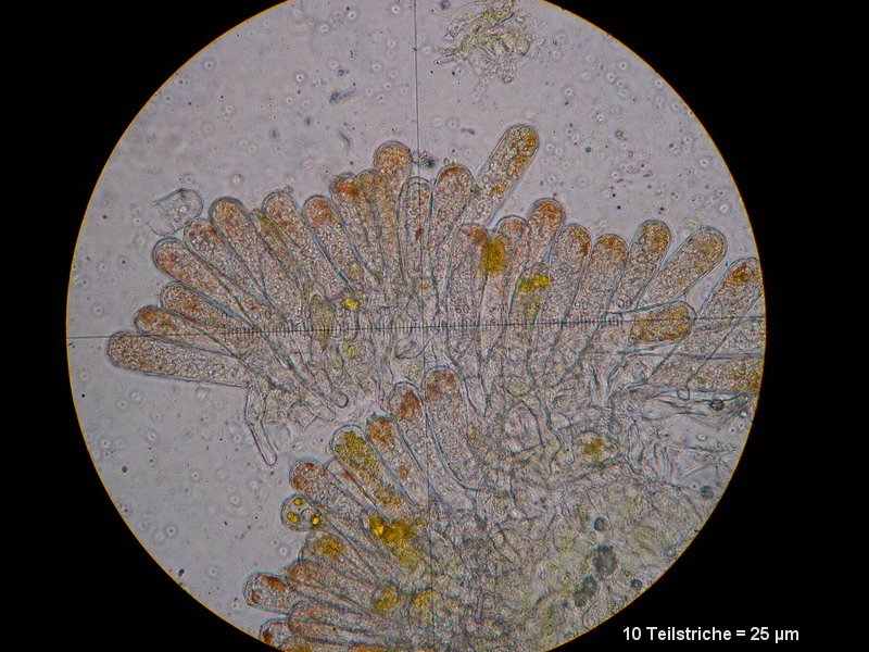 6-Taphrina rhizophora-2.1.6.1.1.50M1-Populus alba.JPG