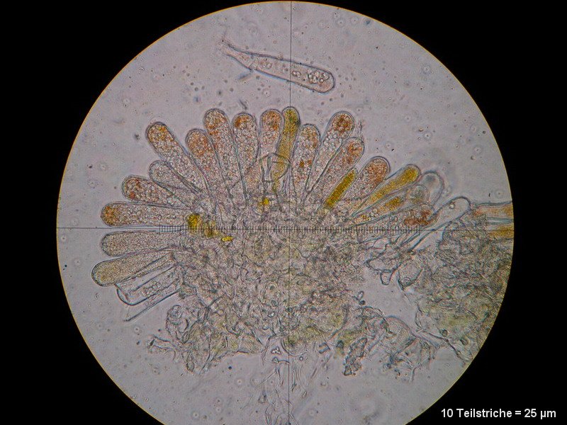 6-Taphrina rhizophora-2.1.6.1.1.50M3-Populus alba.JPG