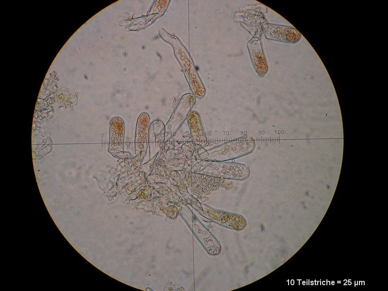 6-Taphrina rhizophora-2.1.6.1.1.50M4-Populus alba.JPG