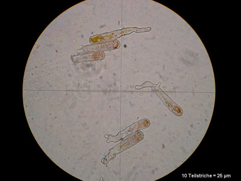 6-Taphrina rhizophora-2.1.6.1.1.50M5-Populus alba.JPG