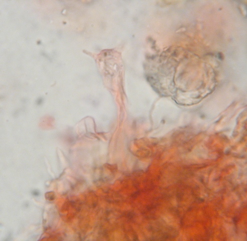 Basidie Exobasidium japonicum in Kongo Ammoniak 1000-fach