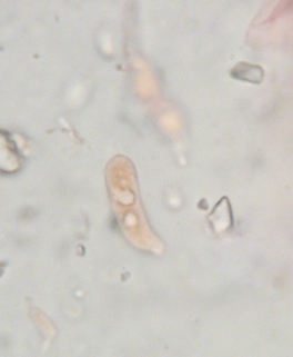 Basidie Exobasidium japonicum in Kongo Ammoniak, 1000-fach