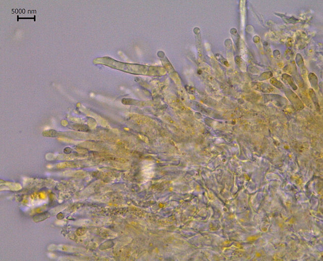 Aecidium euphorbiae3.jpg