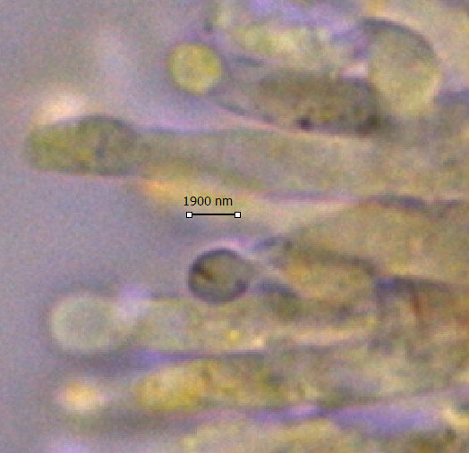 Aecidium euphorbiae4.jpg